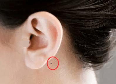 女人/男人耳朵后面有痣代表什么意思